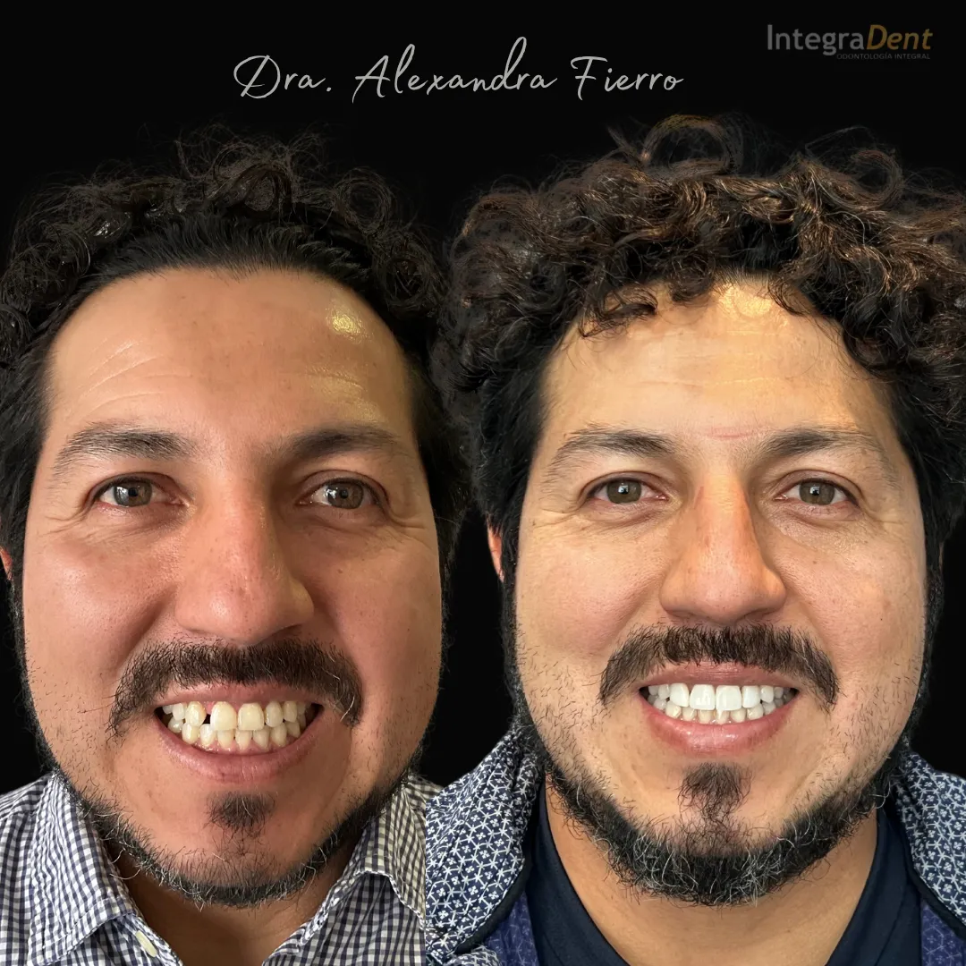 Estética Dental