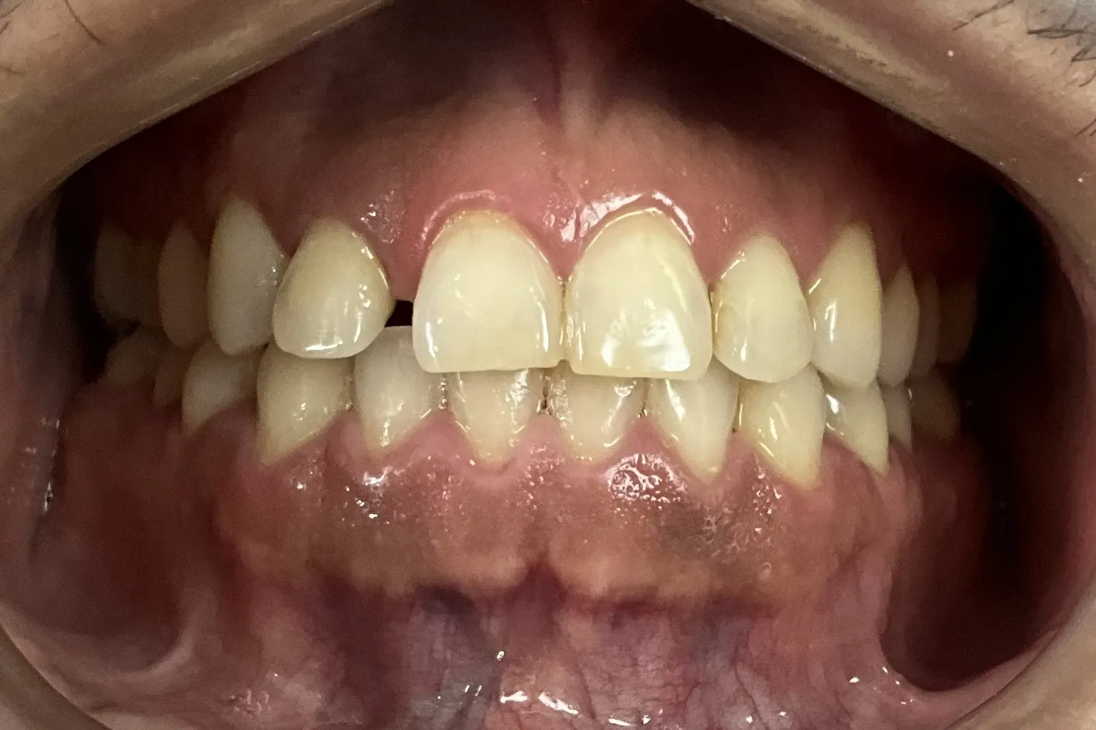 /estetica-dental/Casos/1/2.webp