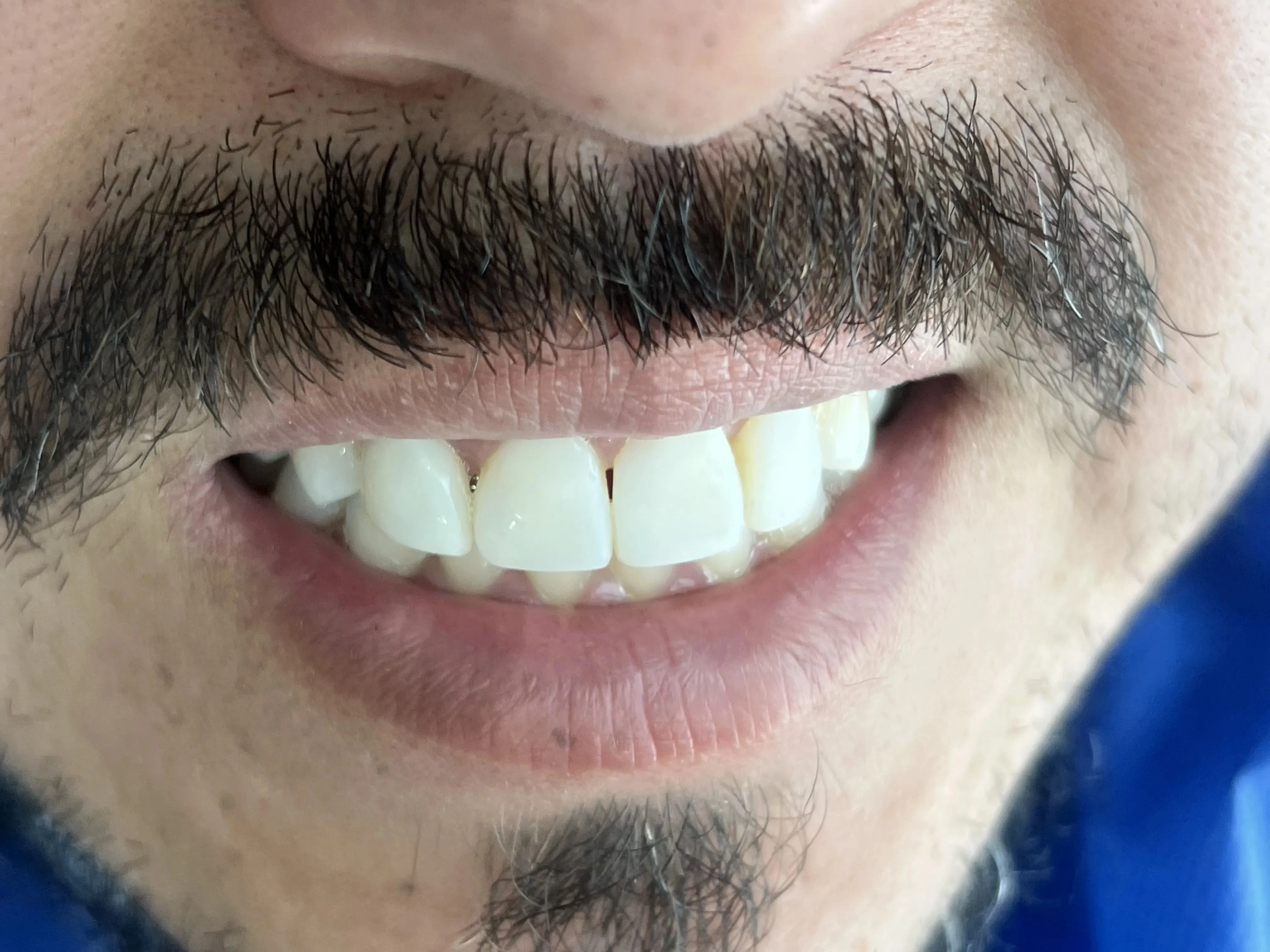 /estetica-dental/Casos/1/3.webp