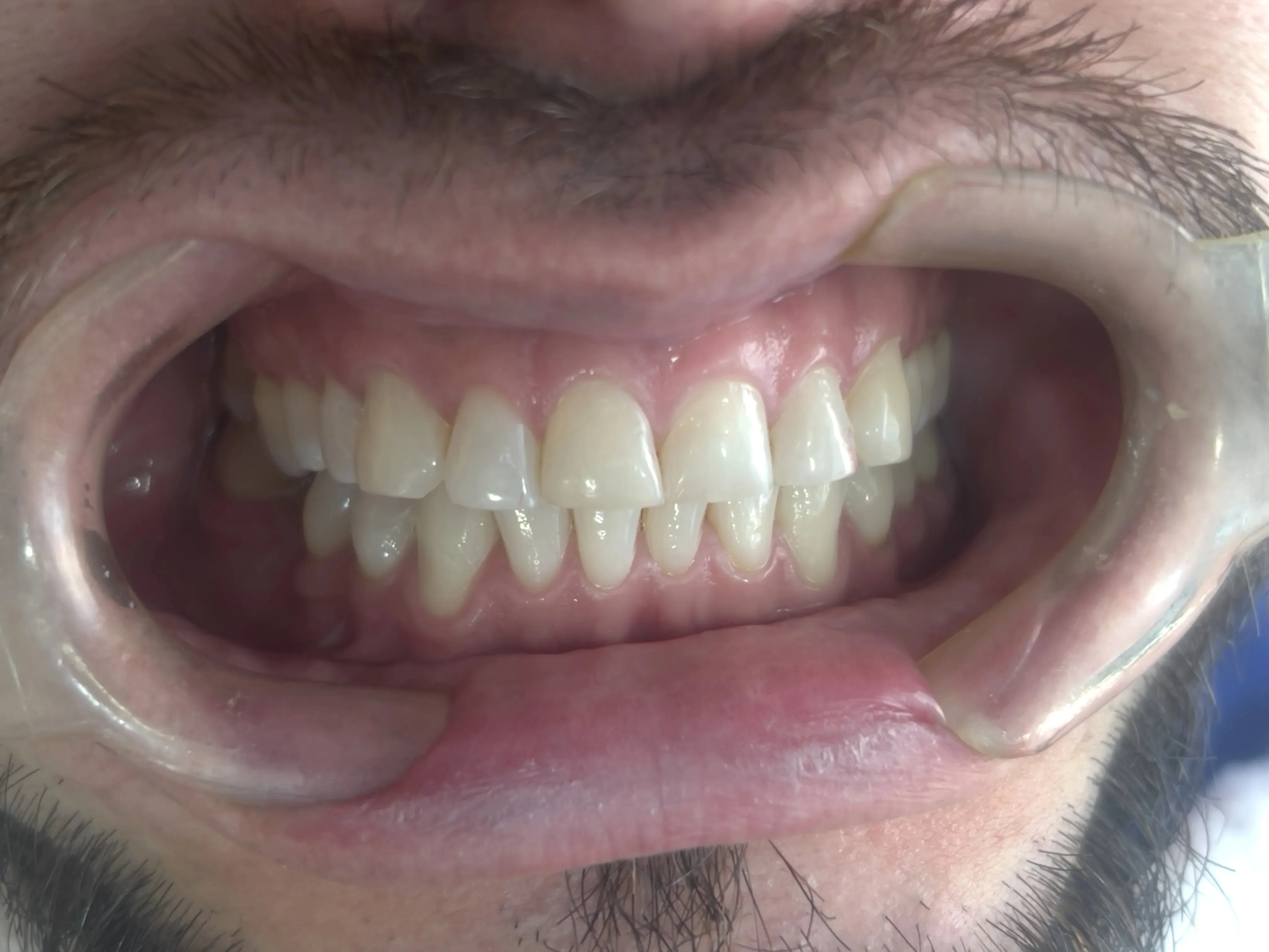 /estetica-dental/Casos/3/1.webp
