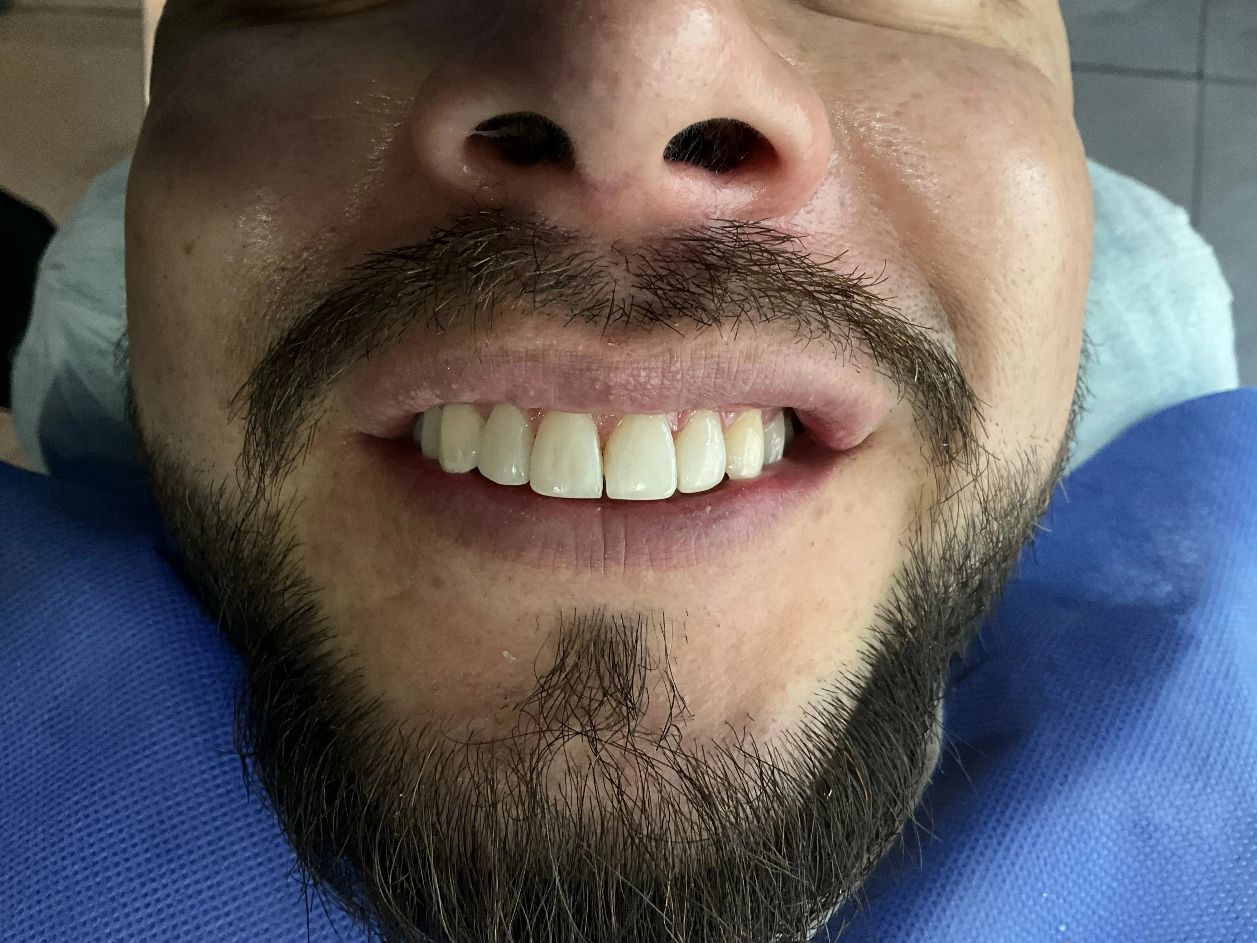 /estetica-dental/Casos/3/2.webp
