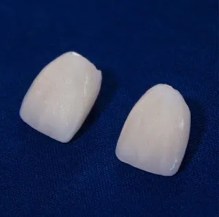 Implantes Dentales