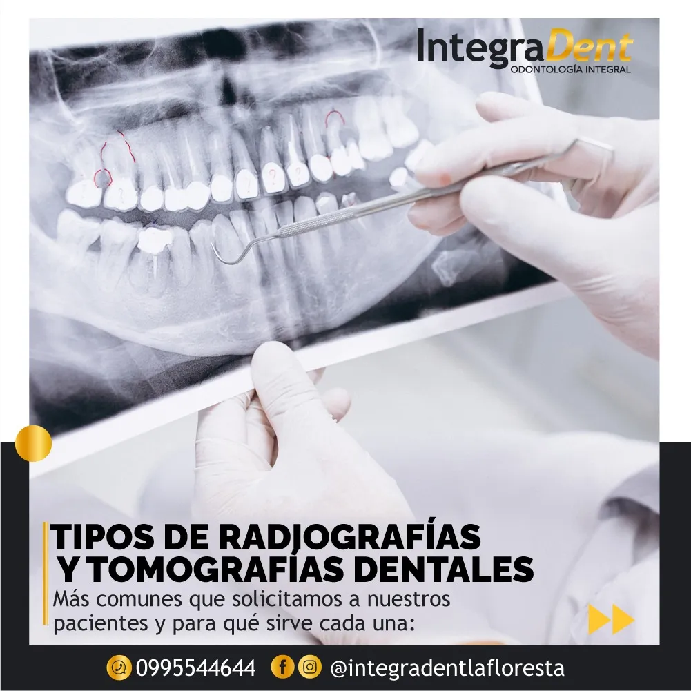 Radiografías y Tomografías Dentales